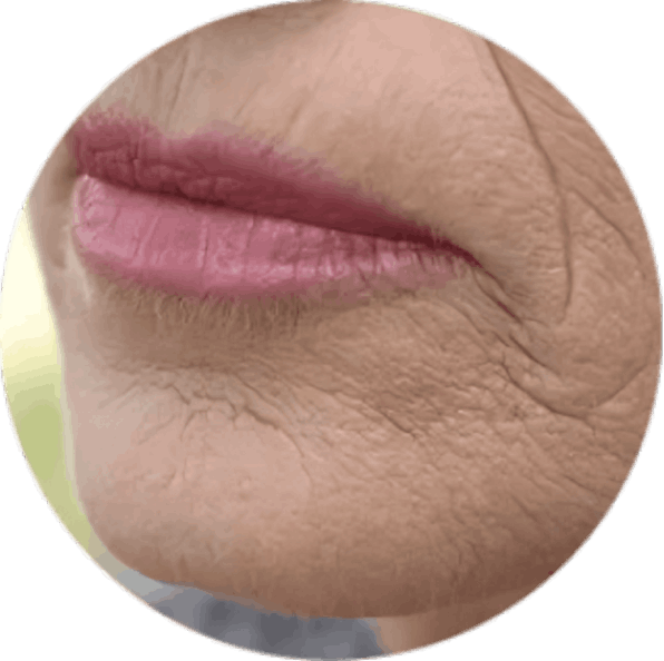 GloraMD Face Lift Serum