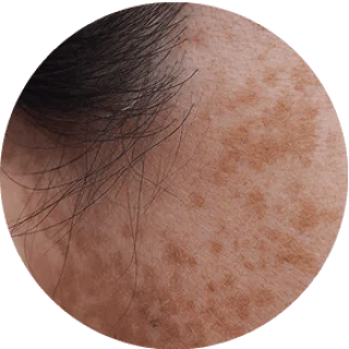 GloraMD Face Lift Serum